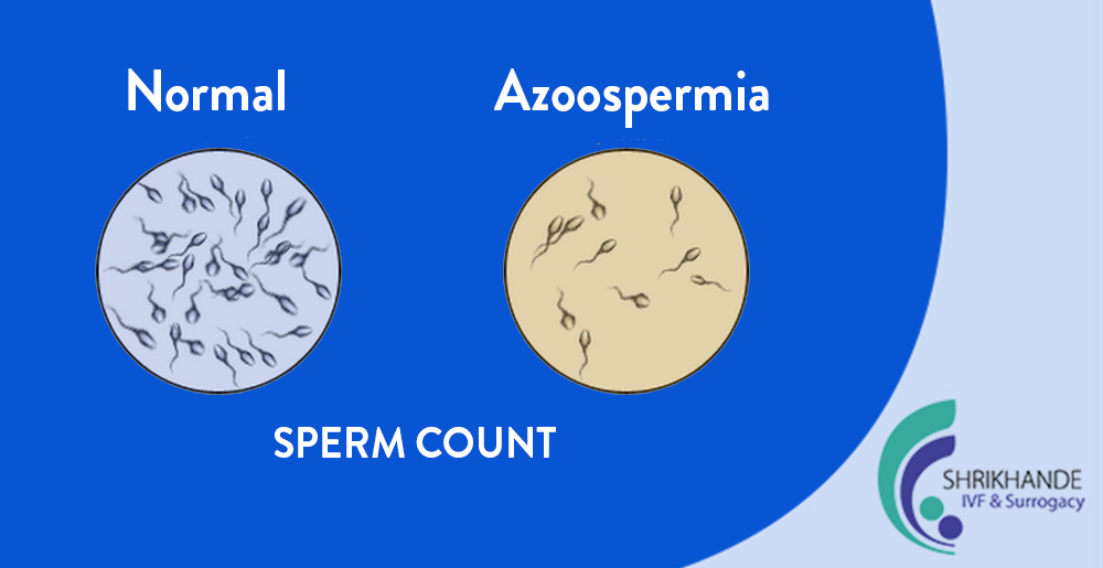 Azoospermia treatment