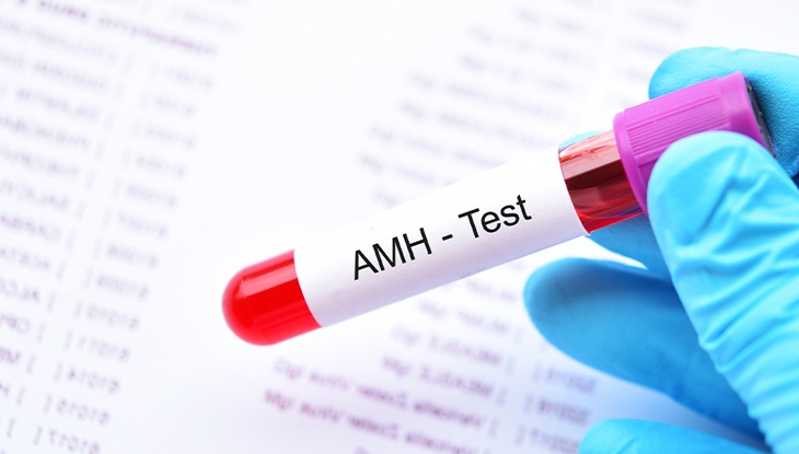 AMH Test
